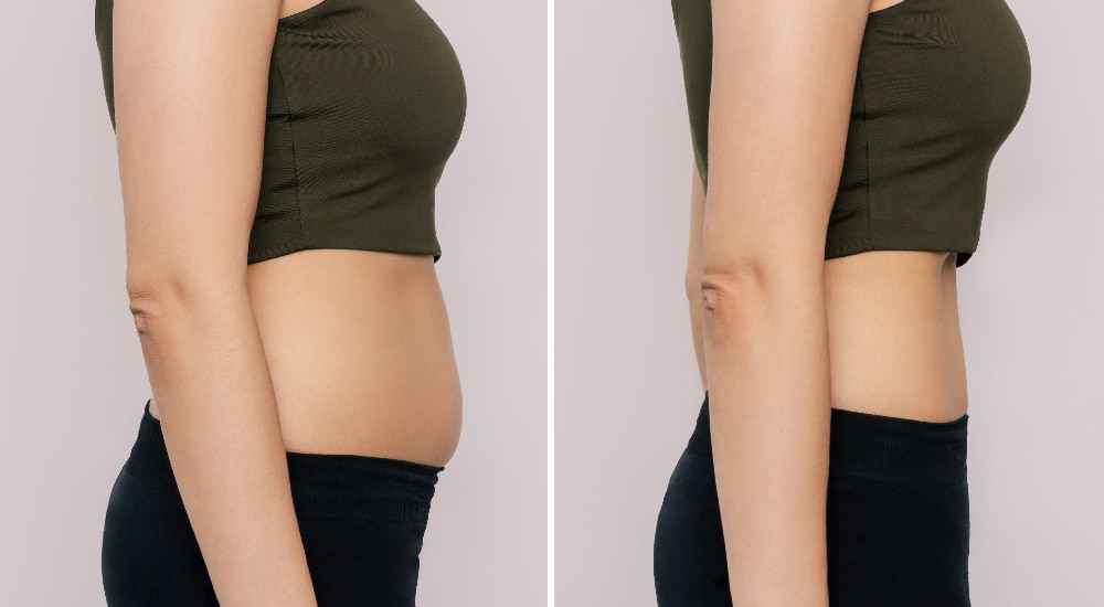 Can you really lose weight without dieting?