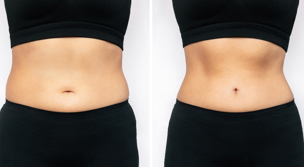 The science behind gender and fat storage