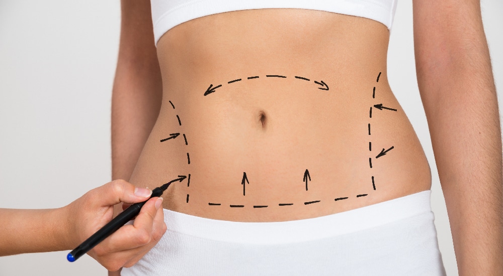 What to expect from your BelleSculpt experience