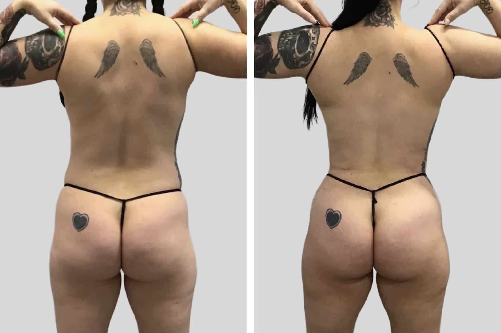 Before and After Image: Flanks and Back - back