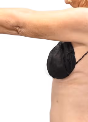 Brazilian Butt Lift in Utah & Idaho